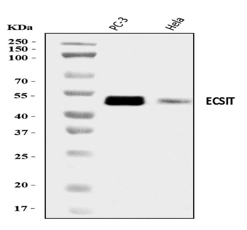 PC-3 and HeLa cells